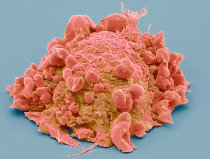 Scientists Unveil Ultra - Precise 3D Tumor Cell Maps and 'Molecular Clocks'